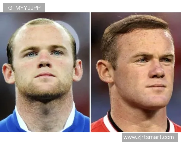 足球明星医美前后对比图赏析展现他们的魅力与自信之美